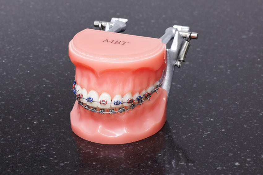 Multibracketapparatur